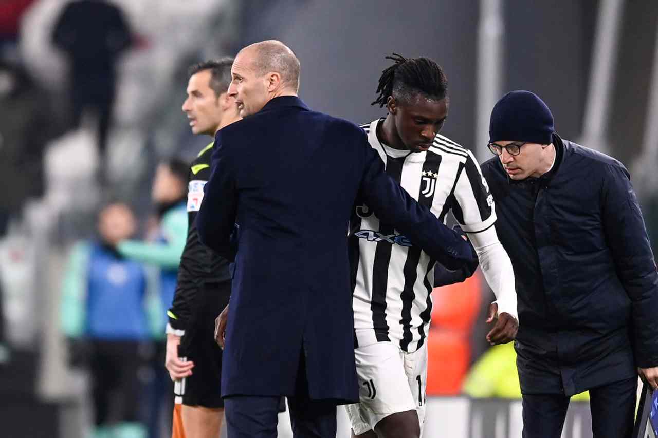 Allegri Kean